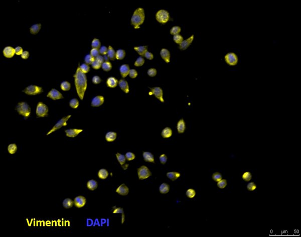 D425 Med Human Medulloblastoma Cell Line SCC290